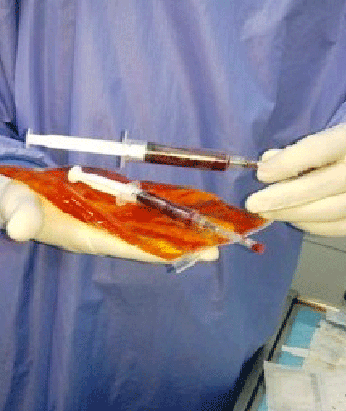 intravenous