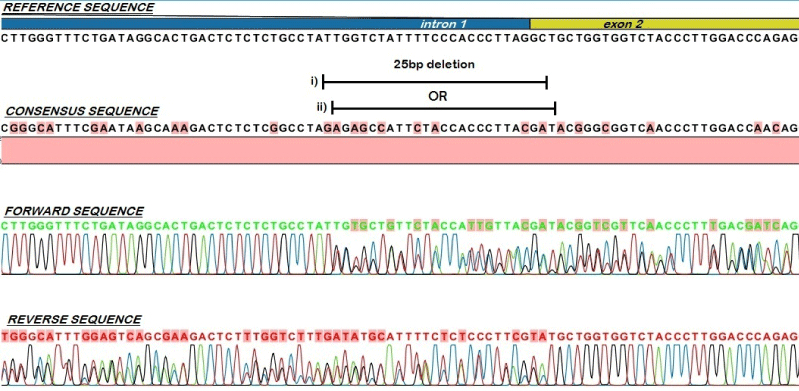 sequencing