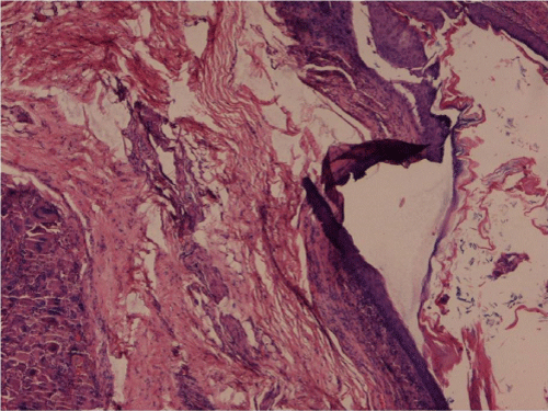 Photomicrograph