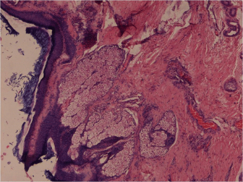 Photomicrograph