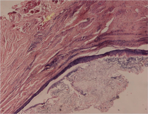 Photomicrograph
