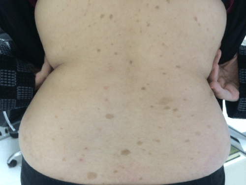 large