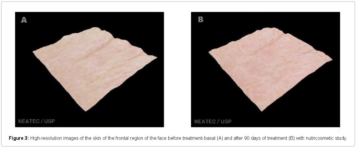 Clinical-Pharmacology-High-resolution-images-skin-frontal-region