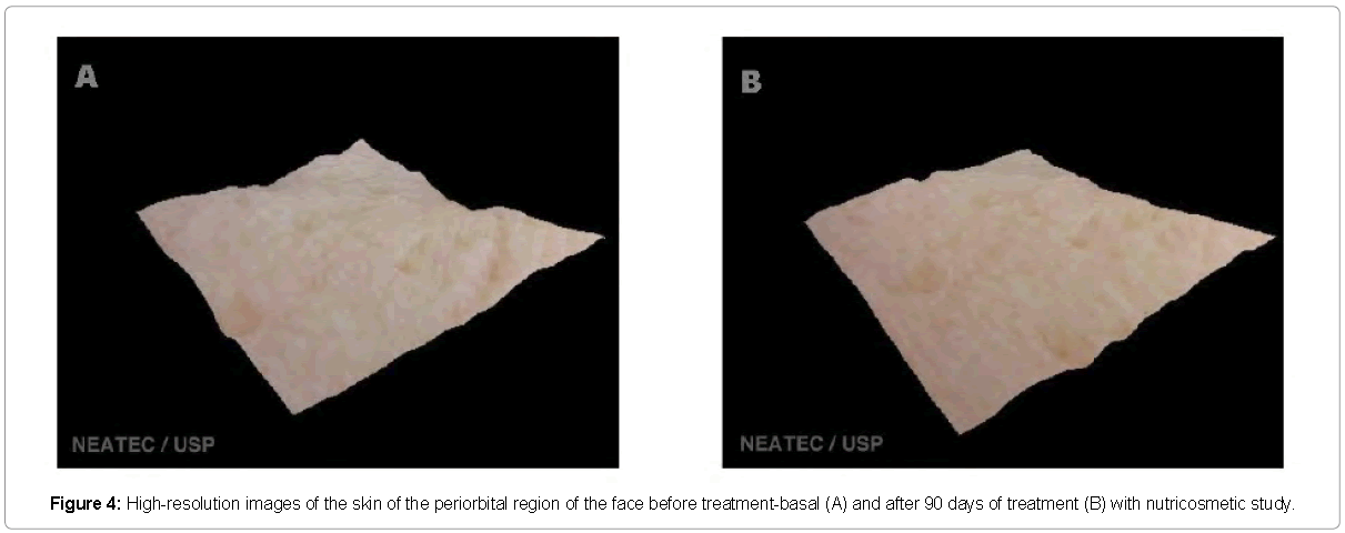 Clinical-Pharmacology-High-resolution-images-skin-frontal-region