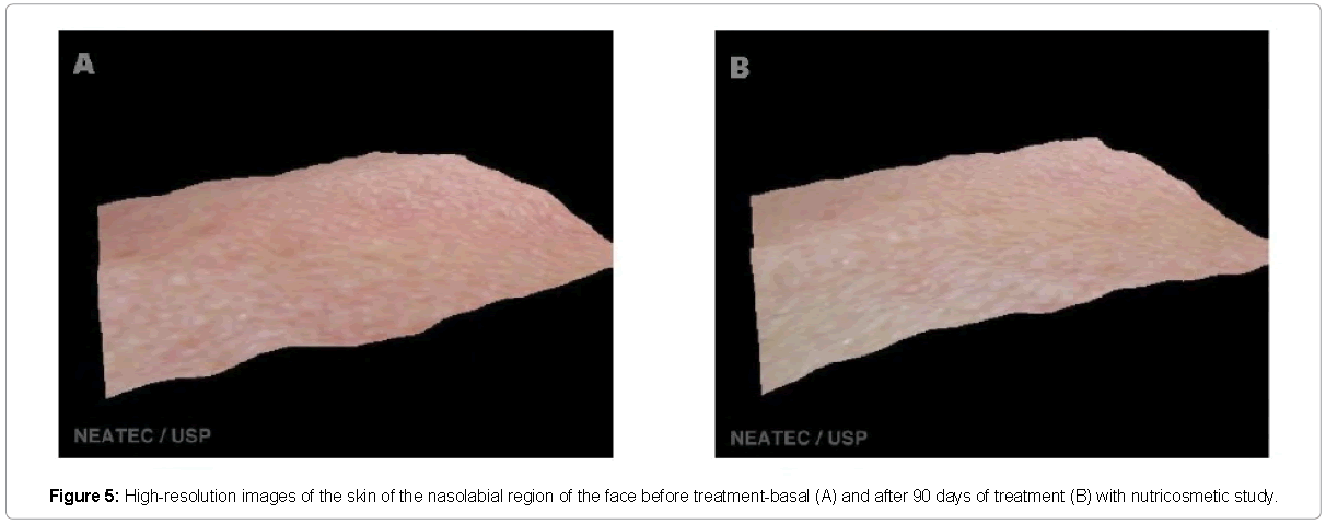 Clinical-Pharmacology-High-resolution-images-skin-frontal-region