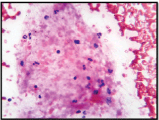 Lymphocytes