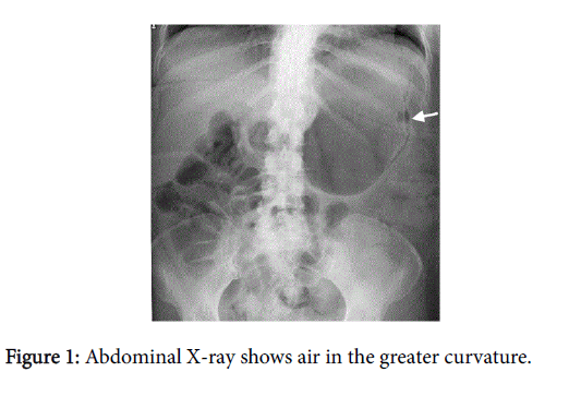 Digestive-System-Abdominal-X-ray