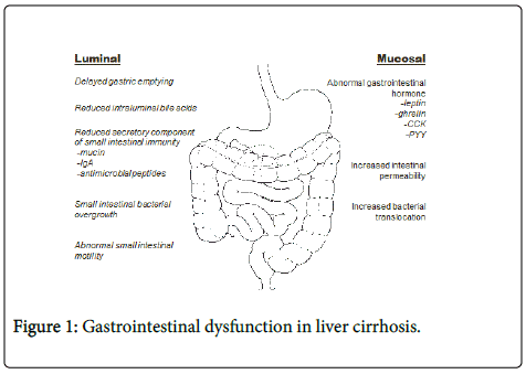 Clan gastrointestinal. Картen St/Ox Gastrointestinal в. Capsule for Gastrointestinal System. Gastrointestinal Radiology with Label.