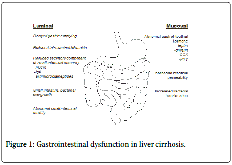 Digestive-System-Gastrointestinal-dysfunction