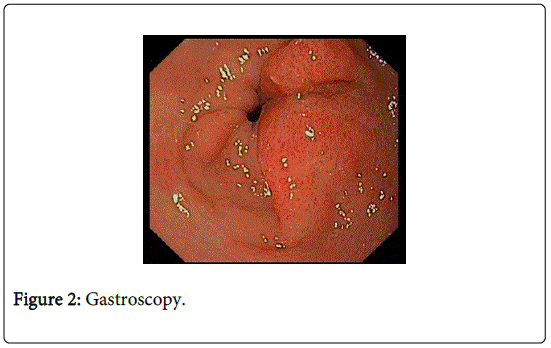 Digestive-System-Gastroscopy