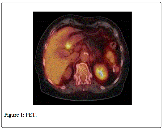 Digestive-System-PET