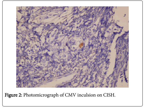 Digestive-System-Photomicrograph-CMV-inculsion-CISH