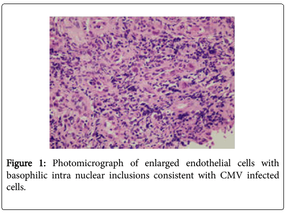 Digestive-System-Photomicrograph-enlarged-endothelial-cells
