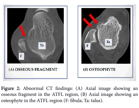Foot-Ankle-Abnormal-CT