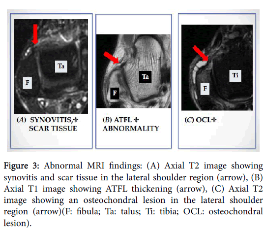Foot-Ankle-Abnormal-MRI