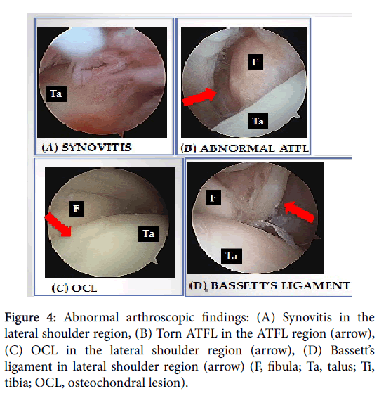 Foot-Ankle-Abnormal-arthroscopic