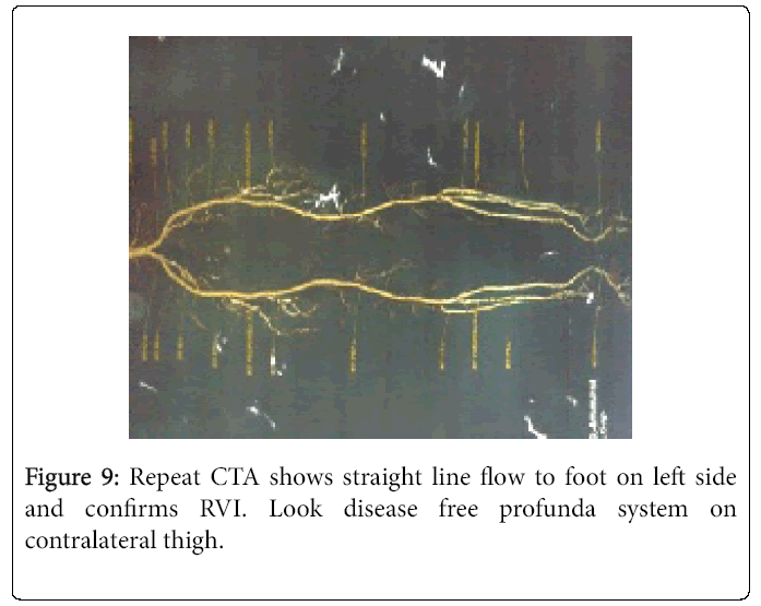 Foot-Ankle-Repeat-CTA-shows-straight-line-flow-foot