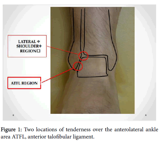 Foot-Ankle-anterolateral-ankle