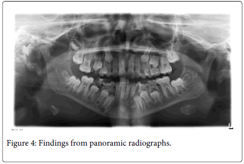 Interdisciplinary-Medicine-Dental-Findings-panoramic-radiographs