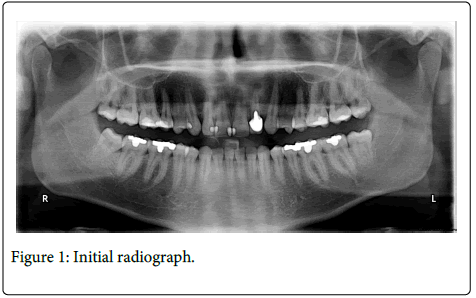 Interdisciplinary-Medicine-Dental-Initial-radiograph
