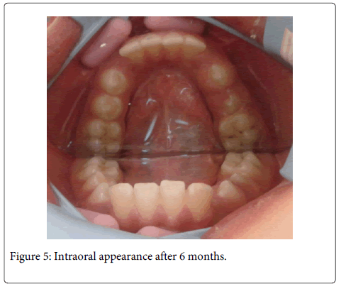 Interdisciplinary-Medicine-Dental-Intraoral-appearance-months