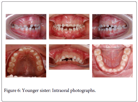 Interdisciplinary-Medicine-Dental-Intraoral-photographs