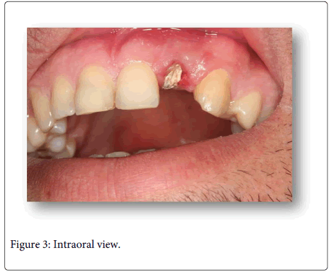 Interdisciplinary-Medicine-Dental-Intraoral-view