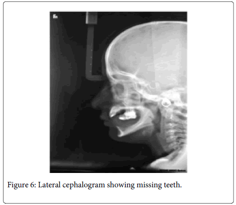 Interdisciplinary-Medicine-Dental-Lateral-cephalogram-teeth