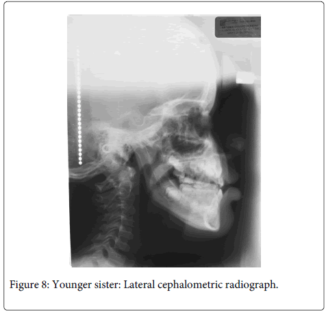 Interdisciplinary-Medicine-Dental-Lateral-cephalometric-radiograph