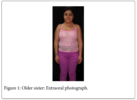 Interdisciplinary-Medicine-Dental-Older-sister-Extraoral-photograph