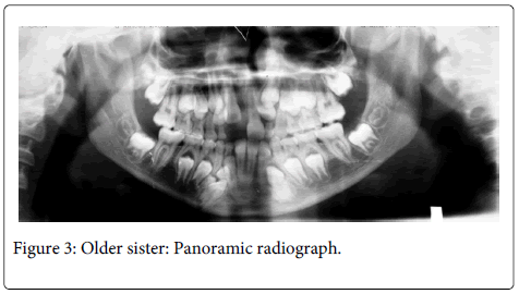 Interdisciplinary-Medicine-Dental-Older-sister-Panoramic-radiograph