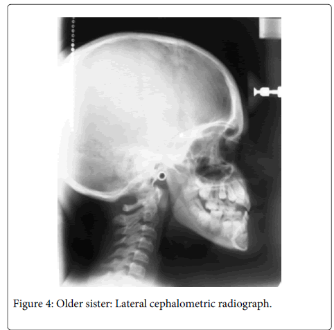 Interdisciplinary-Medicine-Dental-Older-sister-cephalometric-radiograph