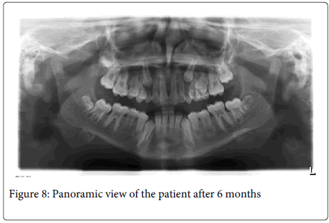 Interdisciplinary-Medicine-Dental-Panoramic-view-patient