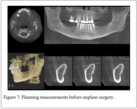 Interdisciplinary-Medicine-Dental-Planning-measurements-surgery