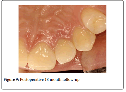 Interdisciplinary-Medicine-Dental-Postoperative-month-follow-up