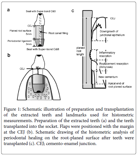 Interdisciplinary-Medicine-Dental-Schematic-illustration-transplantation