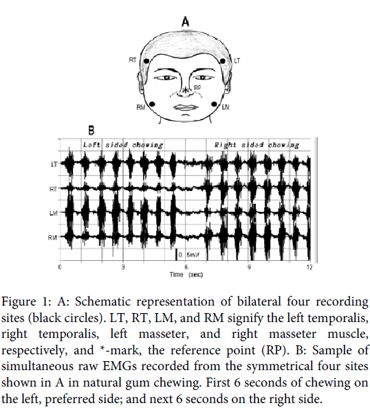 Interdisciplinary-Medicine-Dental-Schematic-representation-bilateral