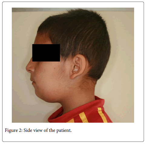 Interdisciplinary-Medicine-Dental-Side-view-patient