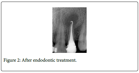 Interdisciplinary-Medicine-Dental-endodontic-treatment