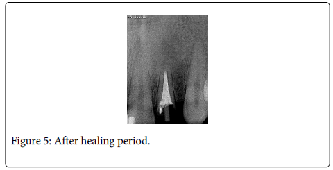 Interdisciplinary-Medicine-Dental-healing-period