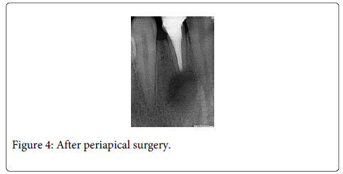 Interdisciplinary-Medicine-Dental-periapical-surgery