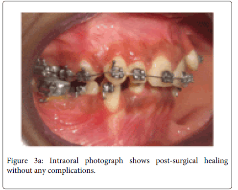 Interdisciplinary-Medicine-Dental-post-surgical-healing