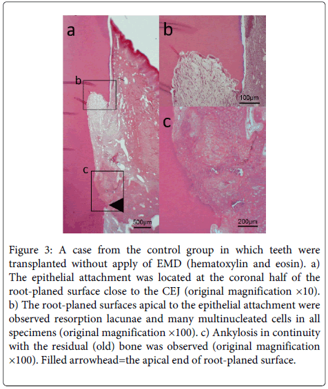 Interdisciplinary-Medicine-Dental-root-planed-surfaces