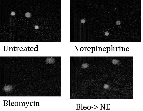 Comet