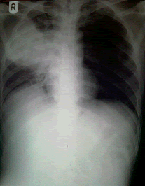 radiograph