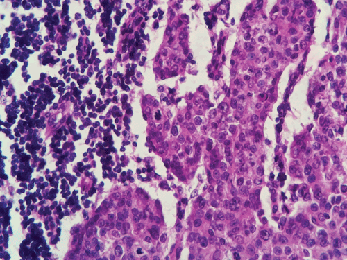 Photomicrograph