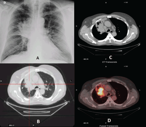 Diagnostic