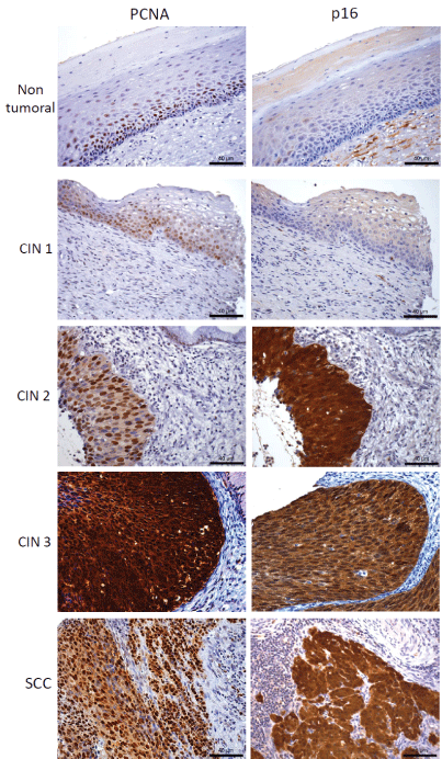 immunohistochemical