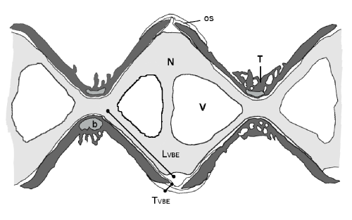 longitudinal
