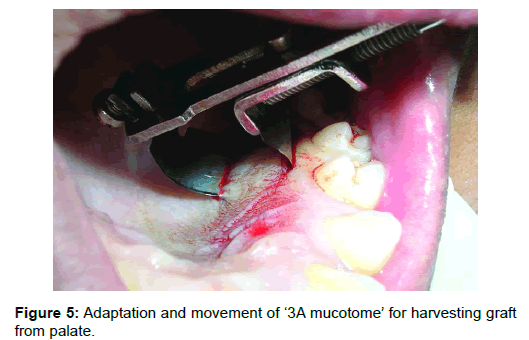 Medicine-Dental-Adaptation-and-movement